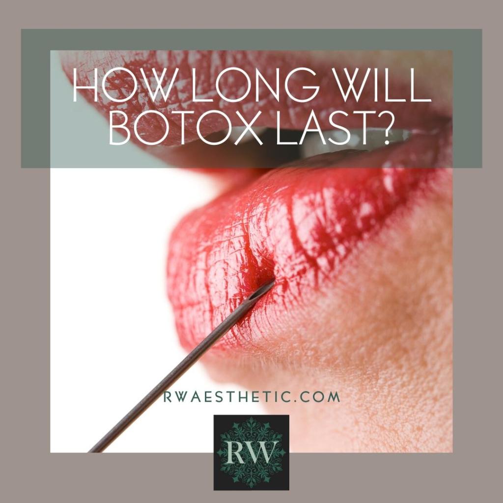 RW Aesthetics Shropshire-How long will Botox last